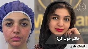 شوهر 👰🏼‍♀️ یا single 👸🏼 ( کلینیک زیبایی ماه زر )