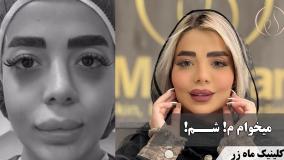 ⁨ یه تصمیم کوچیک، یه حس تازه 💫 ( کلینیک زیبایی ماه زر )