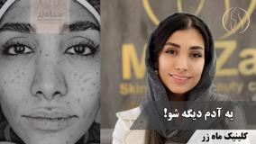 ⁨باورم نمی‌شد… تا اینکه با چشم خودم دیدم!🌟 ( کلینیک ماه زر )