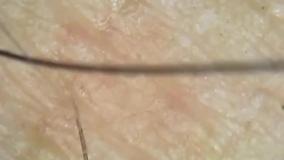 جهان میکروسکوپی پوست انسان