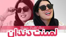 نتیجه لمینت دندان در مشهد