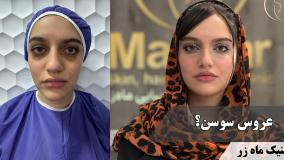 عروس … ( کلینیک زیبایی ماه زر )