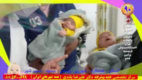 ختنه دوقلو تیزهوش ایرانی بدون درد بدون خونریزی. استاد دکتر بلندی