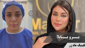 آزادی بعد از ۷۰ 😌💄 ( کلینیک زیبایی ماه زر )