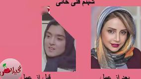 بازیگران زن ایرانی که صورتشان را جراحی کردند! (قبل و بعد شوکه‌کننده)