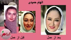 جراحی زیبایی بازیگران زن ایرانی؛ شکست یا موفقیت؟ (مقایسه تصویری)
