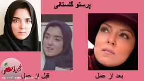 مقایسه عکس بازیگران زن ایرانی: از گذشته تا امروز (+عکس)