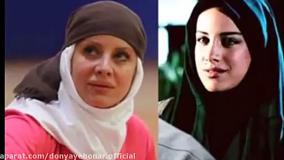 کلیپ دیدنی بازیگران مرد و زن ایرانی قبل و بعد از عمل زیبایی و بینی