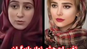 عکس های باورنکردنی از بازیگران زن ایرانی قبل و بعد از عمل زیبایی