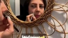 نقاط طلایی لیفت صورت