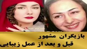 قبل و بعد از عمل زیبایی و آرایش بازیگران محبوب ایران در یک دقیقه