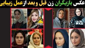 بازیگران زن ایرانی که با گذر زمان زیباتر شدند!