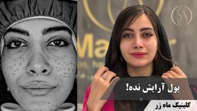 این روزا همه‌مون یه‌جور خسته‌ایم... ( کلینیک زیبایی ماه زر )
