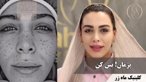 دوستم اومده، آیندش عوض شده ( کلینیک زیبایی ماه زر )