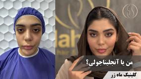 ⁨ همه‌ش می‌خواست خوشگل‌تر از دوستش باشه!😏💄 ( کلینیک زیبایی ماه زر )