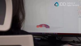 چاپ سه‌بعدی؛ نسل جدید ایمپلنت‌های دندانی