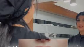 دلایل زردی دندونات رو بشناس!