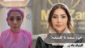 فرم‌دهی و جوانسازی صورت ( کلینیک زیبایی ماه زر )
