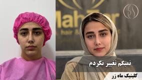 اسلاید آخر و ببینین🌺 ( کلینیک زیبایی ماه زر )