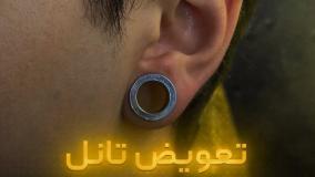 تعویض تانل گوش