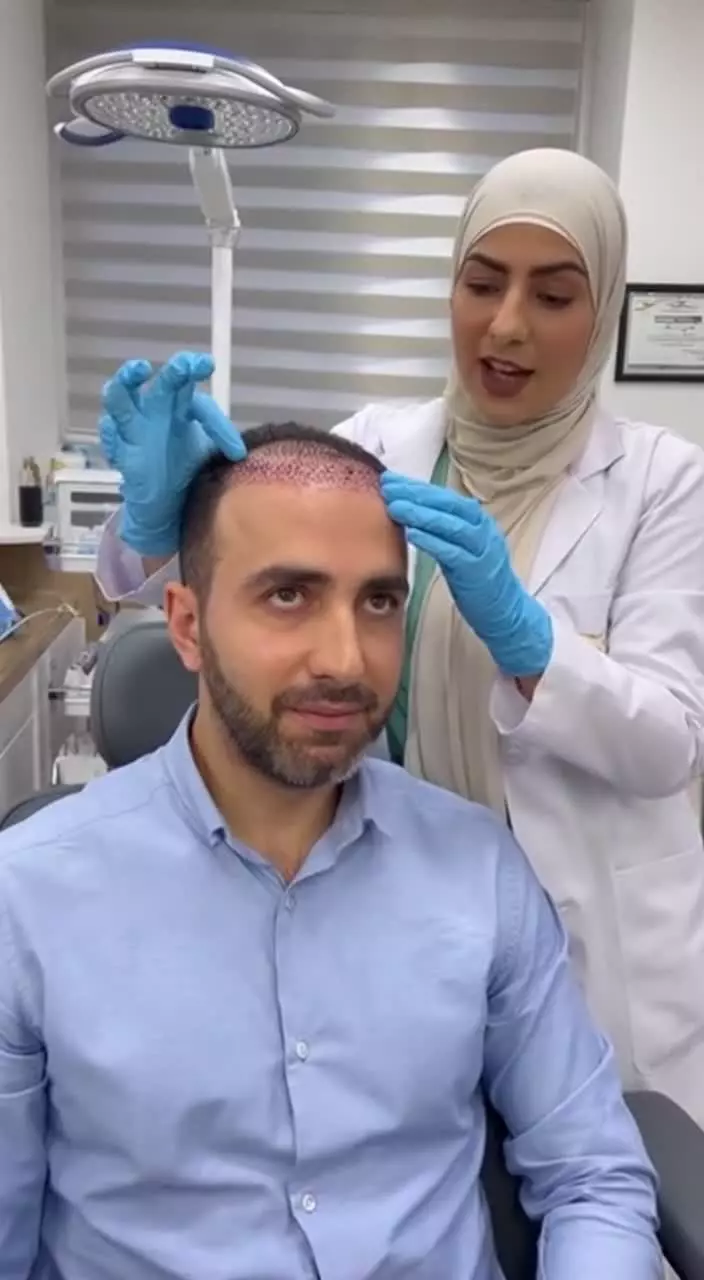 بهترین کلینیک کاشت مو در مشهد