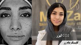 منم مثل تو، وسط این آلودگی تهران! ( کلینیک زیبایی ماه زر )