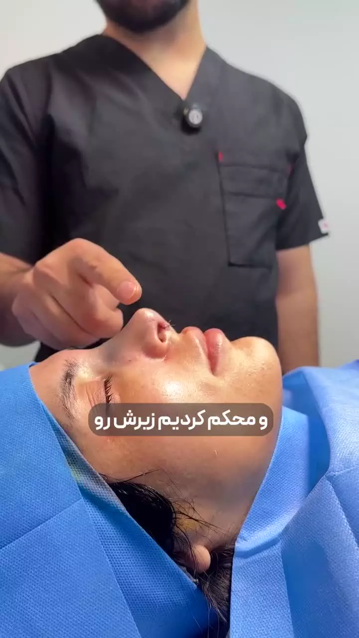 تیپ پلاستی بینی در کلینیک مسیح
