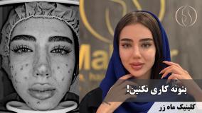 هر روز کلی پول می‌دیم برای لوازم آرایش ( کلینیک زیبایی ماه زر )