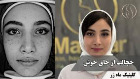 کلی هزینه برای لوازم آرایش! ( کلینیک ماه زر - دکتر میثم ضرغامی )