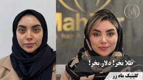 به خودت برس 😍 ( کلینیک ماه زر - دکتر میثم ضرغامی )