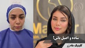 ساده اما اصیل  باش😍 ( کلینیک ماه زر - دکتر میثم ضرغامی )