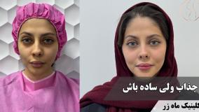 جذاب ولی ساده باش🥰 ( کلینیک ماه زر - دکتر میثم ضرغامی )