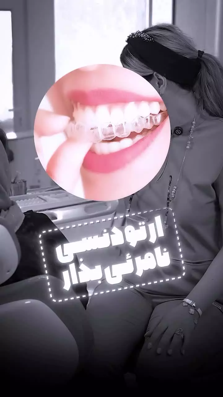 ارتودنسی شفاف