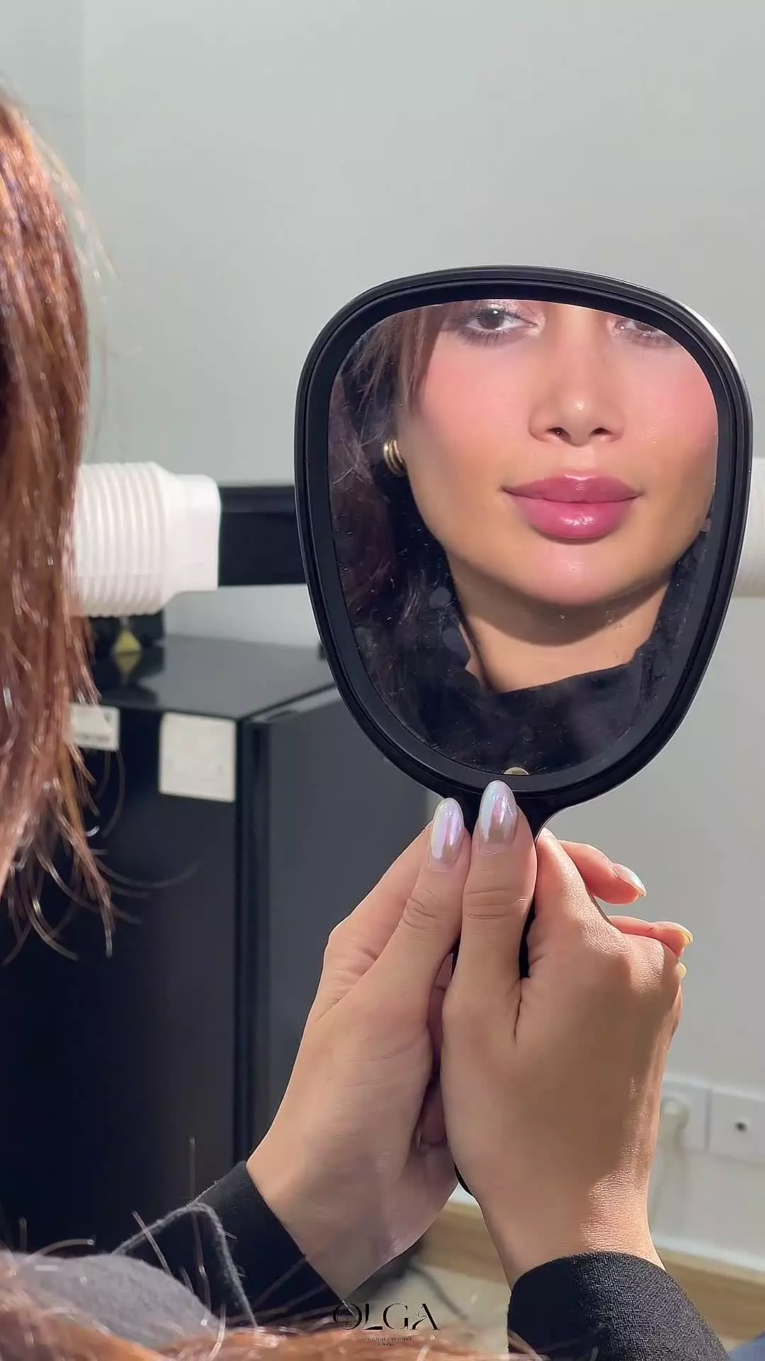 تزریق ژل لب عروسکی