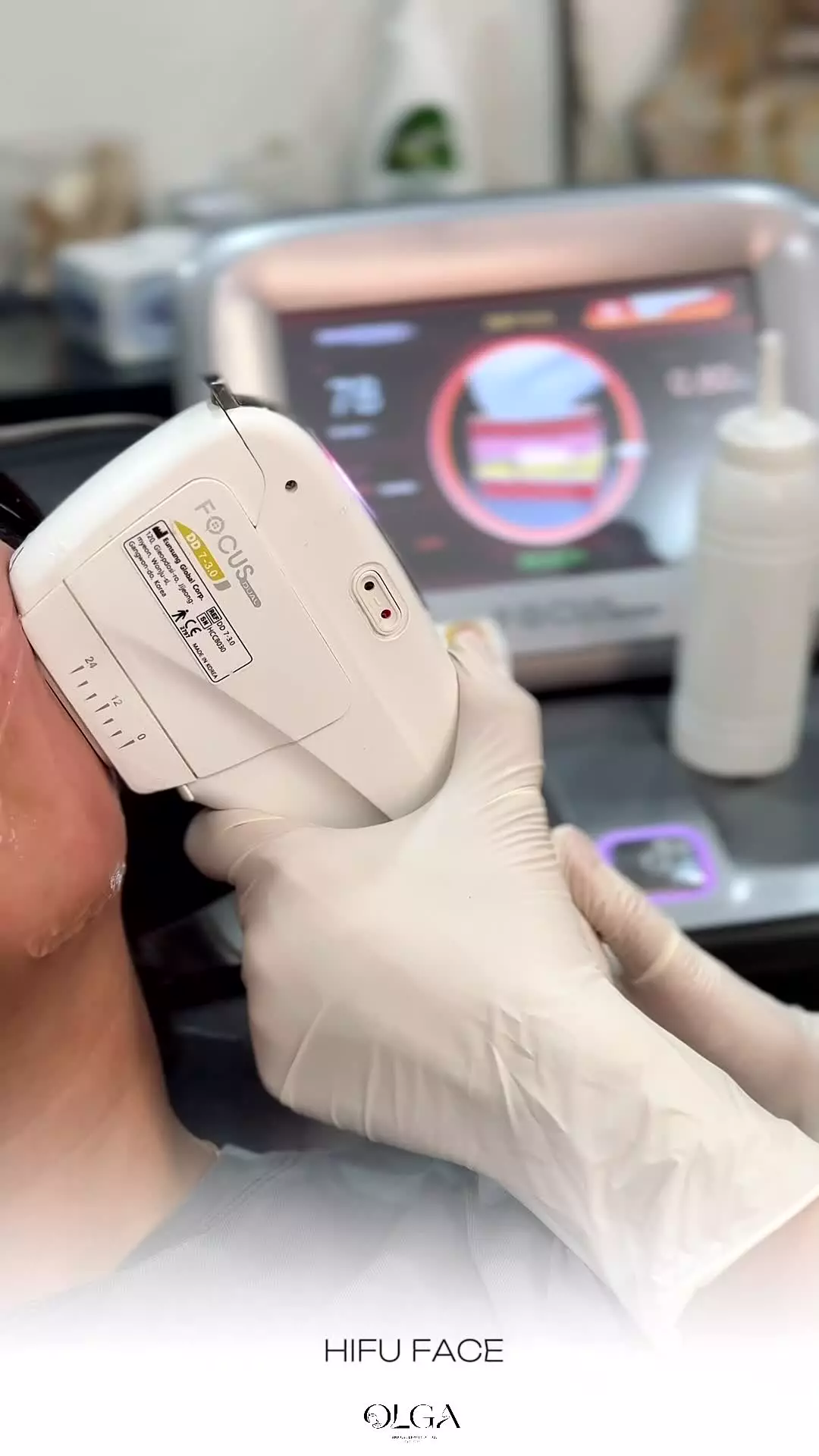 هایفوتراپی صورت