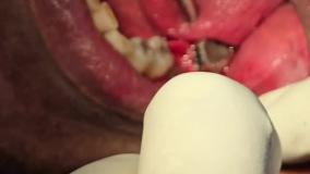 خدمات دندانپزشکی اقساطی در مرکز تهران