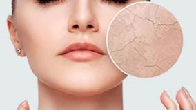 درمان ترک های پوستی