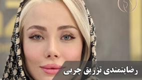 تجربه تزریق چربی بدون درد ( کلینیک ماه زر - دکتر میثم ضرغامی )