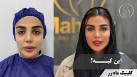 تا اخرش بخون 👌 ( کلینیک ماه زر - دکتر میثم ضرغامی )