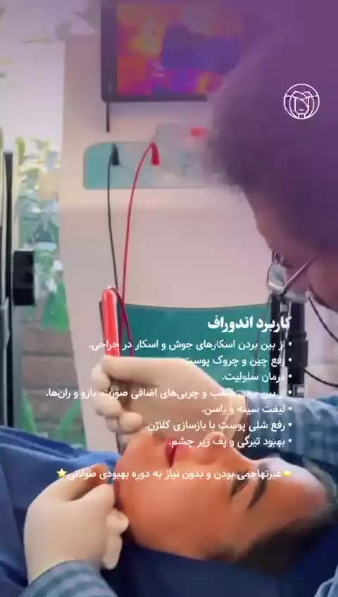 از بین بردن غبغب با دستگاه پزشکی Aphrodite