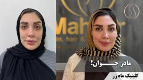 یک مادر جوان ( کلینیک ماه زر - دکتر میثم ضرغامی )