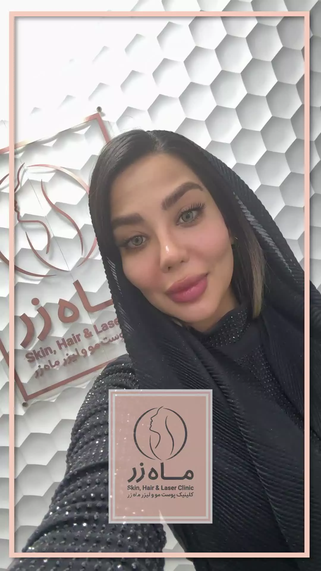 نتیجه‌ای طبیعی با تزریق چربی ✨ ( کلینیک ماه زر - دکتر میثم ضرغامی )