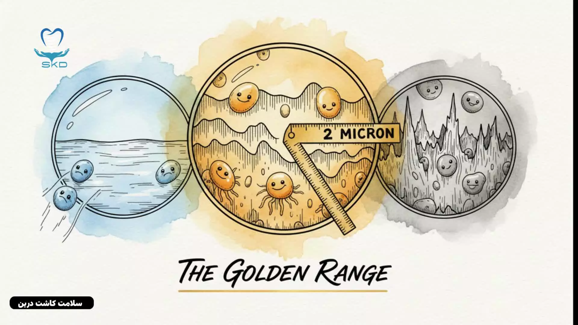 بررسی تأثیر اسیدشویی و آنودایزینگ بر کیفیت سطح ایمپلنت دندان