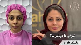 با چربیِ خودم خوشگل‌تر شدم… ( کلینیک ماه زر - دکتر میثم ضرغامی )