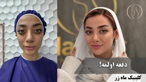 دفعه اولمه ( کلینیک ماه زر - دکتر میثم ضرغامی )