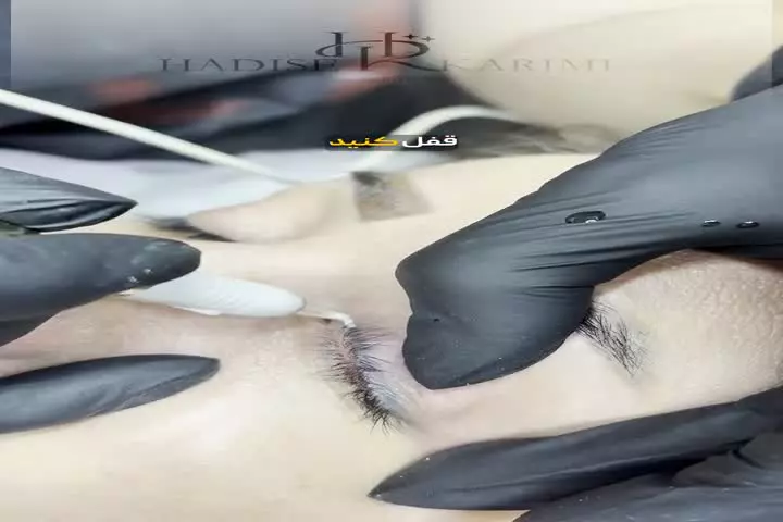 آموزش ریمو خط چشم با جدیدترین متدها در سالن زیبایی حدیث کریمی