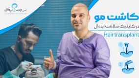 سلامت ایده آل؛ بهترین انتخاب برای کاشت مو