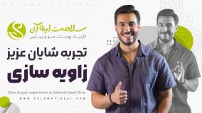 زاویه سازی صورت با تزریق ژل؛ قبل و بعد