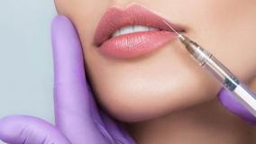 تزریق فیلر لب و چانه :