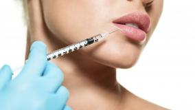 ماندگاری فیلر